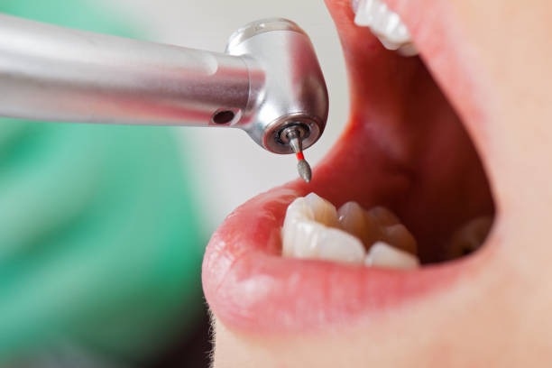 Best Emergency Treatment for Oral Infections in Haleiwa, HI
